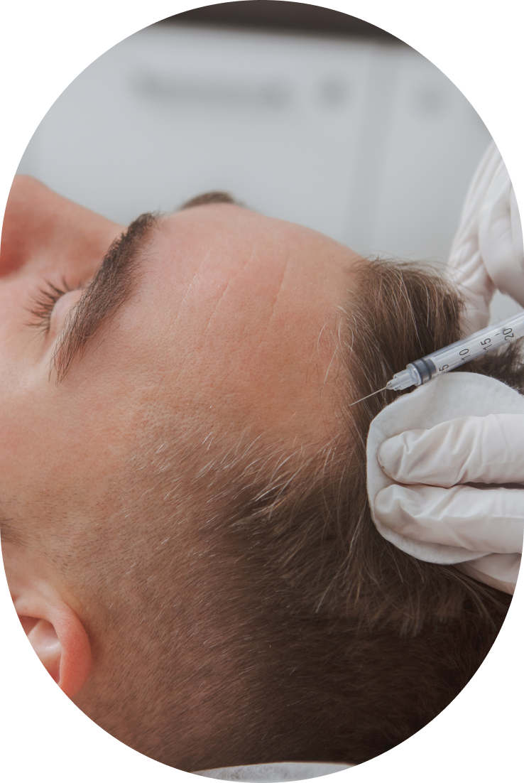 Image rapprochee de la tete d une homme se faisant une injection dans ses cheveux - cheveux | Centre Villiers Batignolles Paris