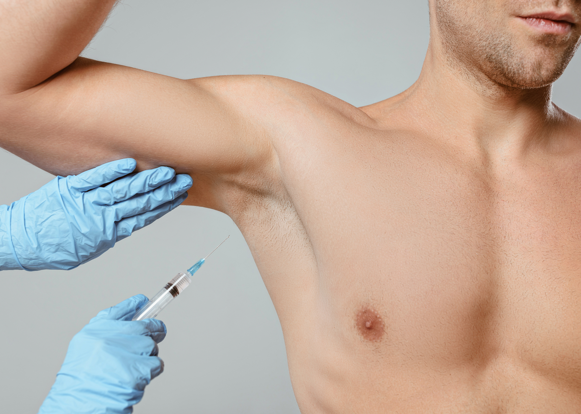 Traitement de l'hyperhidrose des aisselles par injection pour stopper la transpiration excessive. Centre Villiers Batignolles, Paris.