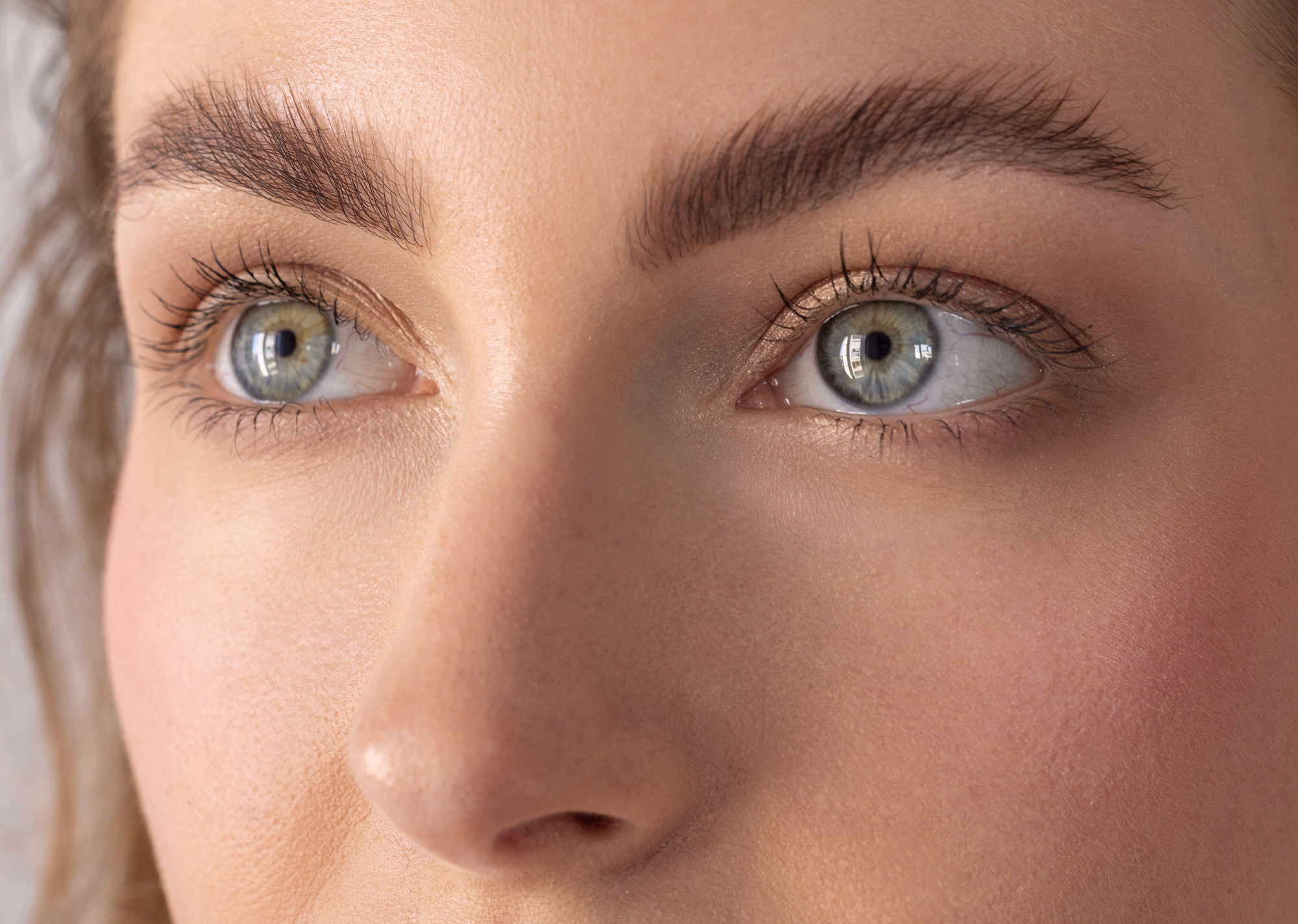 Injection de toxine botulique pour lisser la ride du lion située entre les sourcils. Centre Villiers Batignolles, Paris.