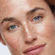 Acide hyaluronique ou botox : quelles différences